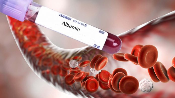Albumin Darah: Penanda Kesehatan Penting bagi Lansia